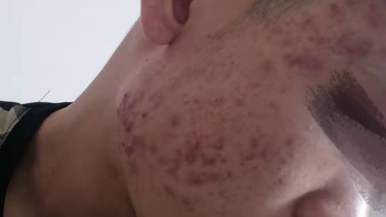 孫世正源耳穴綜合療法