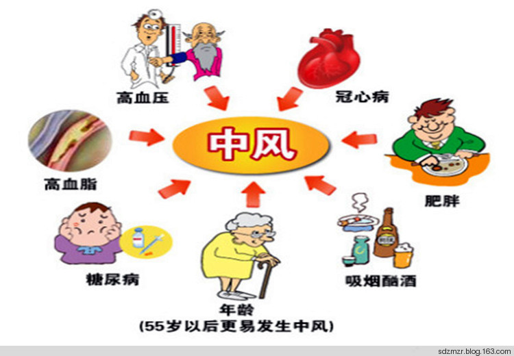 中风的10个症状 眩晕 短时间的语言困难和浑身乏力 突然发生剧烈的
