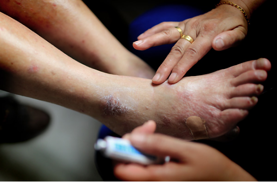 (看着老人腿上因瘙痒被抓出的血痕,全梦惠心疼不已并细心地为老人擦药