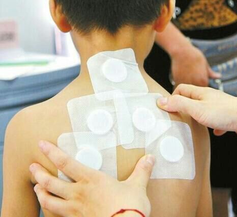 儿童提高免疫力艾灸图图片