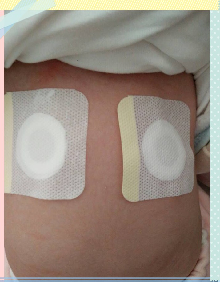 融安妇幼有特色,中医治疗巧介入